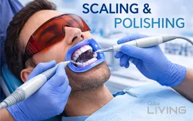 Dental Scaling & Polishing